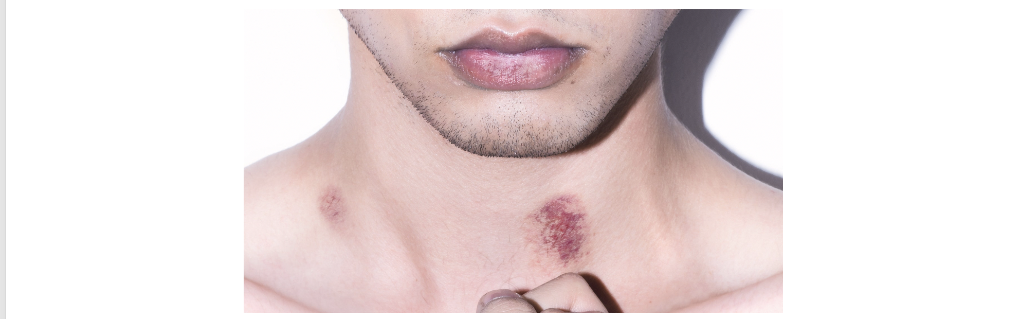 Covering Up a Career Hickey | The Tim Sackett Project